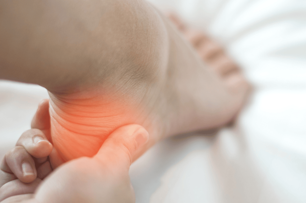 Chiro for Plantar Fasciitis - Symptoms