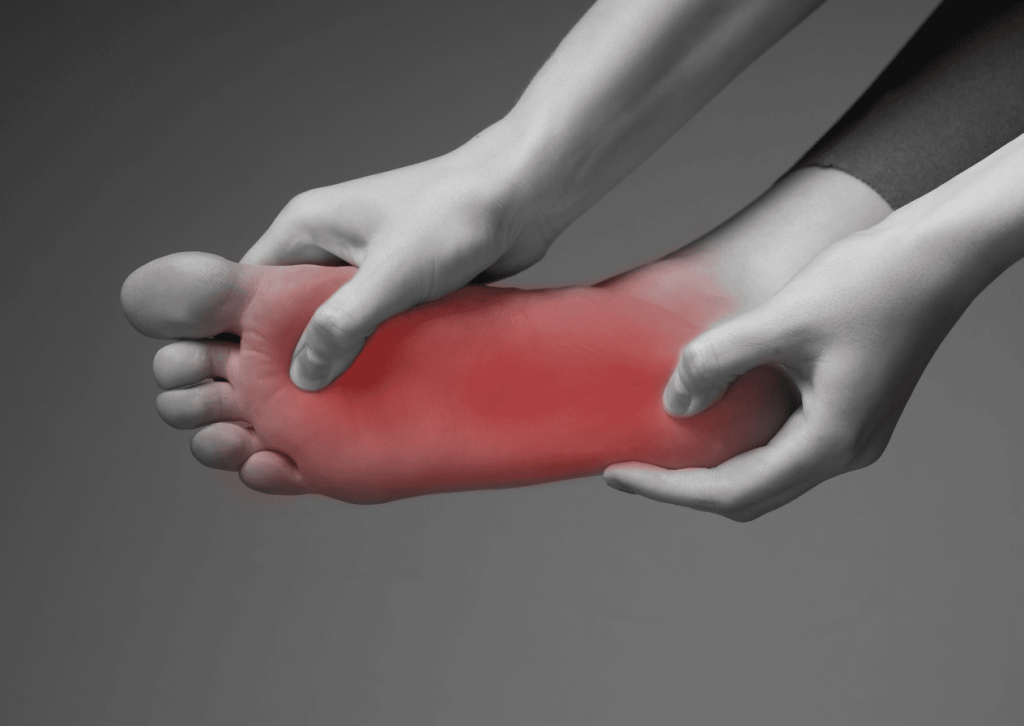 Plantar fasciitis pre Chiropractic adustments